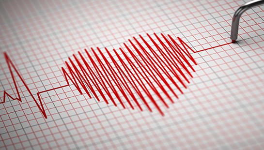 URGENCIAS CARDIOVASCULARES