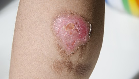 URGENCIAS DERMATOLÓGICAS